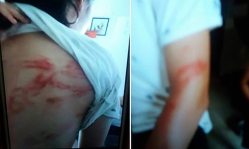 Bố đẻ bạo hành hai con dã man ngay giữa Thủ đô ảnh 1